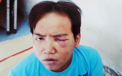 Bàn giao bảo vệ sát hại bé trai cho Công an TP.HCM điều tra