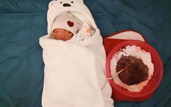 Giật mình sản phụ tự sinh con “thuận tự nhiên”