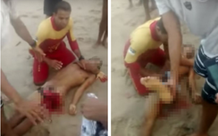 Đi bơi tại vùng biển nguy hiểm bị cá mập cắn đứt "của quý"