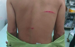 Vung dao chém kiểm lâm táo tợn vì... không xin được gỗ bị bắt