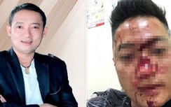 Danh hài Chiến Thắng phủ nhận thuê vệ sĩ đánh người