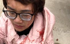 Nữ hành khách tố nhà xe hành hung vì thắc mắc giá vé cao