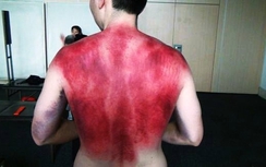 Clip: Kỳ lạ chữa bệnh bằng phương pháp tát thâm tím người