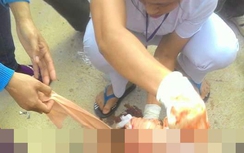 Giang hồ đòi nợ thuê bị chém lìa tay, gục chết trên vũng máu