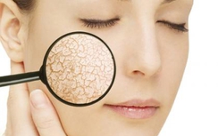 Điều hòa đã "giết chết" da bạn như thế nào?