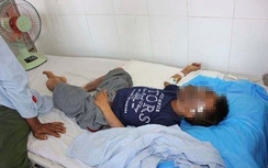 Ngã vào bếp củi đang cháy, bé trai bị bỏng hoàn toàn khuôn mặt