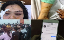 Hé lộ nguyên nhân vụ thiếu nữ nghi bị cắt tai ở Sài Gòn