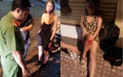 Giúp bạn bị tai nạn, du khách nước ngoài bị trộm xe máy