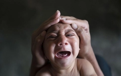 Phát hiện trường hợp nhiễm virut Zika đầu tiên tại Phú Yên