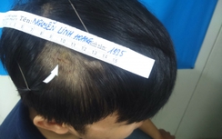 Nhận diện nhóm hung thủ hành hung PV Báo Giao thông