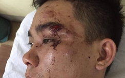 Bị nhắc nhở, côn đồ tấn công người đi đường và công an