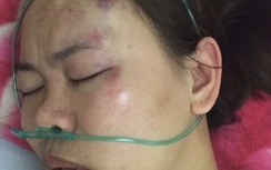 Côn đồ hành hung nữ giám đốc ngay cổng chợ