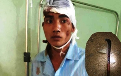 Khởi tố kẻ “ảo giác” chém vợ, giết con 2 tuổi vào ngày 8/3