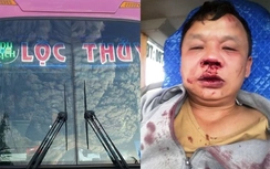 Bị tố hành hung lái xe nhập viện, chủ xe Lộc Thủy nói gì?