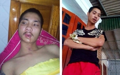 Đưa con trai mất trí ra Hà Nội phẫu thuật, bị lạc mất con