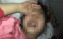 Phó Thủ tướng yêu cầu báo cáo vụ xâm hại bé gái ở HN