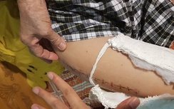 Phạt tài xế taxi đâm gãy chân HS trường Nam Trung Yên 2,5 triệu