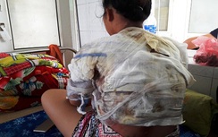 Chồng dội nước sôi lên người vợ sau khi nói chuyện ly hôn