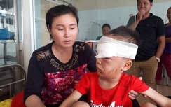 Bé trai 6 tuổi bị chó nhà cắn rách mặt