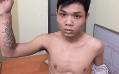 Kẻ buôn ma túy tự rạch cổ, 3 trinh sát phải phơi nhiễm HIV