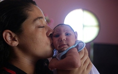 Anh phát hiện 4 trường hợp nhiễm virus Zika