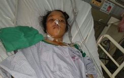 Một thai phụ bị áp xe gan vì 40 con giun chui ống mật