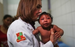 Hé lộ 2 người Việt đầu tiên dính virus Zika