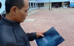 Mời chuyên gia hàng đầu xử lý vụ "quên kéo trong bụng bệnh nhân"