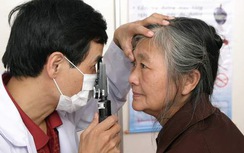 Cần giá hợp lý trong thanh toán chi phí BHYT với thủy tinh thể