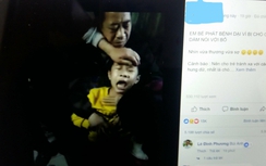 Clip trẻ kêu "oắc oắc" sau khi bị chó cắn, bác sĩ nói gì?