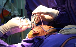 Kinh hoàng bệnh nhân bị hàng trăm mảnh kim loại găm vào mặt