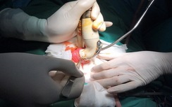 Kinh hãi đầu vòi xịt lọt trong hậu môn nam thanh niên 18 tuổi