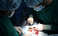 Cứu kịp thời bệnh nhi vỡ phình bóc tách động mạch chủ