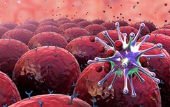 Phụ nữ khỏe mạnh cũng phải khám ung thư ngay khi có dấu hiệu này