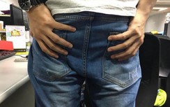 Thói quen nhịn đi đại tiện suốt 20 năm khiến người đàn ông bị ung thư đại trực tràng