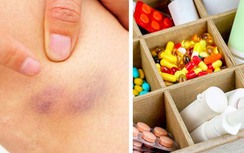 Nếu hay bị các vết bầm tím không rõ lý do, có thể bạn mắc các bệnh này
