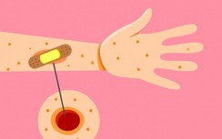 9 dấu hiệu cho biết căn bệnh tiểu đường đang tấn công bạn