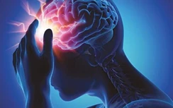 Nghiên cứu mới nhất: Virus Corona có thể "ẩn nấp" trong não gây tái nhiễm