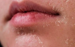 Nếu thấy 3 dấu hiệu bất thường này xuất hiện cùng lúc, hãy cẩn trọng