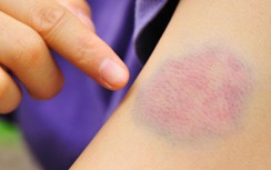 Sáng thức dậy có 7 dấu hiệu này, nên đến bệnh viện kiểm tra lập tức