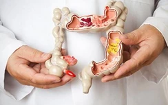 Ai nói ung thư là "án tử", 5 loại ung thư này có tỷ lệ chữa khỏi rất cao