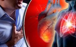 Trắc nghiệm: Muốn tránh căn bệnh "sát thủ" nguy hiểm nhất toàn cầu phải biết những điều này