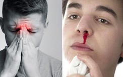 Có những dấu hiệu này phải khám ung thư mũi và xoang ngay kẻo "hối không kịp"