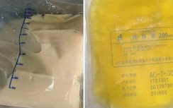 Ăn thức ăn nhanh quá nhiều, huyết tương của chàng trai trông như trà sữa