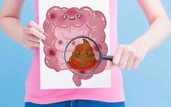 Đi vệ sinh có 3 dấu hiệu này, coi chừng ung thư ruột "gõ cửa"