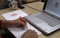 Mắc bệnh hiếm gặp, người đàn ông không thể phân biệt được từ số 2 đến số 9