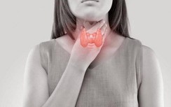 Không phải dưa muối, 4 "thứ" này mới là nguyên nhân gây ra ung thư tuyến giáp