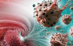 Trắc nghiệm: Hàng triệu người mắc ung thư vì không biết điều này