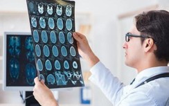 Cặp vợ chồng cùng nhập viện vì nhồi máu não do loại thực phẩm vạn người mê