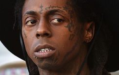 Rapper nổi tiếng nhập viện vì chứng động kinh, cẩn trọng với dấu hiệu này